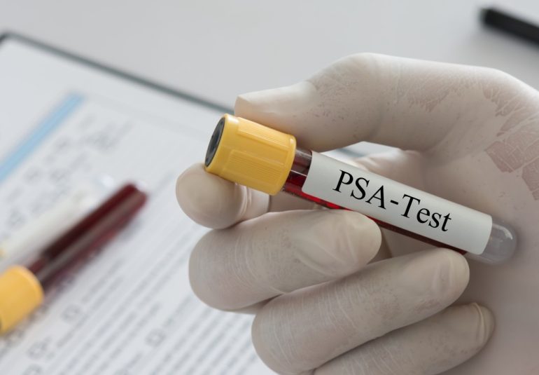 Cancer Screening (Male)