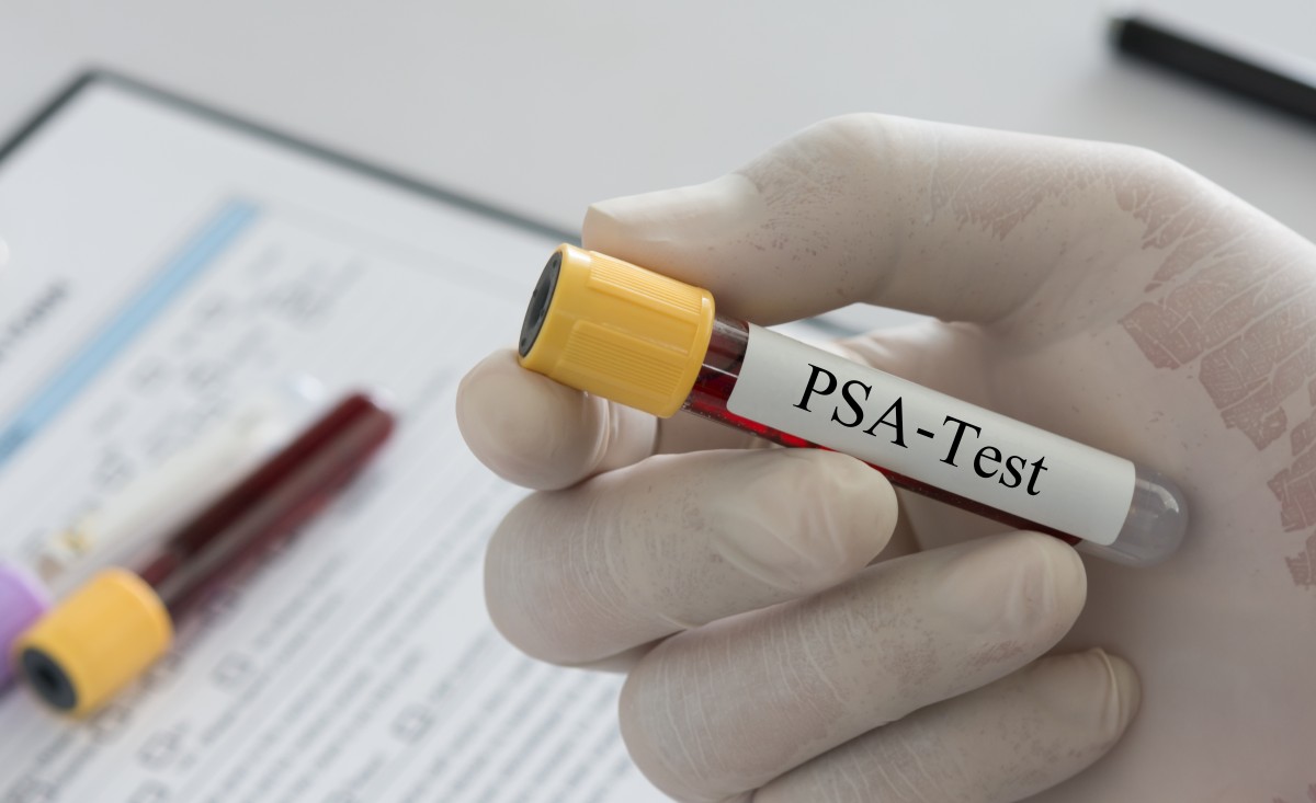 Cancer Screening (Male)