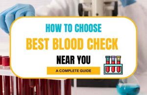 Guide to choosing blood check services. Blood Test Near Me