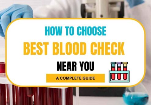 Guide to choosing blood check services. Blood Test Near Me